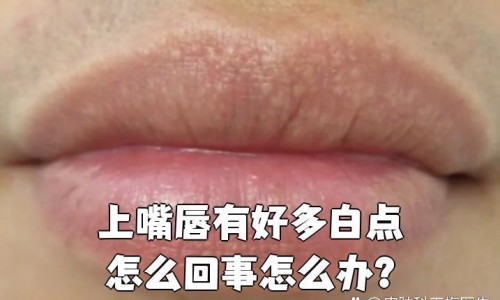 减肥期间可以喝醋吗-减肥期间可以喝雀巢咖啡么网 | 减肥期间可以喝杨梅汁吗,减肥期间可以喝电解质水吗